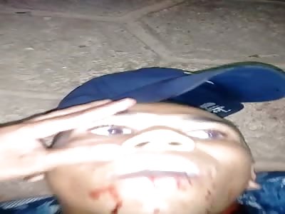 Thief in Extreme Agony After a shoots in Head and Chest