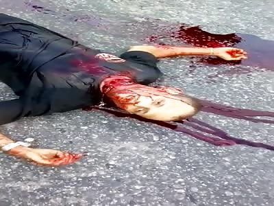 Slit in the Throat Losing All of his Blood and Died on the Road