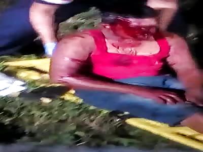 Face Shattering Motorbike Crash in Brazil.
