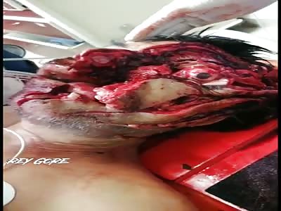 Farmer Disfigured from Brutal Machete Attack