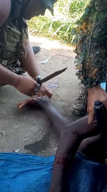 Traffickers Torture Their Own , Mutilate His Foot for For Being Off Duty.