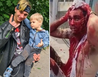 Young Russian Scalped by Chechenian for Having his Hair Colored.