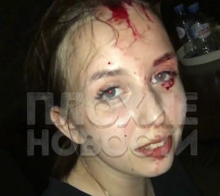 (Action & Aftermath) Girl Refused Drunk Guy at a Club = Bottle Over Head