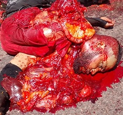 Extremely Graphic Aftermath - An Accident Scene You Won't Forget