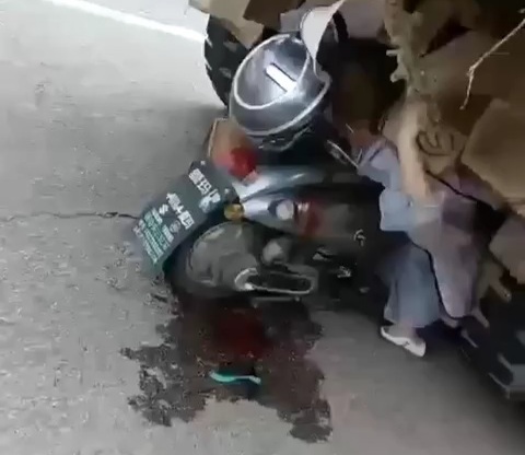 Woman on a Scooter Rear Ends a Dump Truck with Her Face