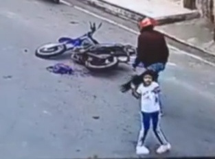 Little girl lost her arm trapped in motorcycle chains 