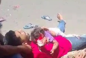 crying father holding his dying baby girl with her skull cracked 