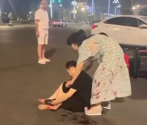 Chinese man have his leg broken due to moped crush 