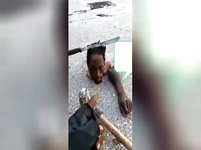 Haitian Savages Left Machete In His Head
