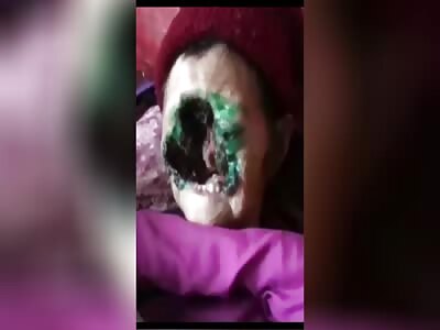 WTF: Rotting Face of an old Mother