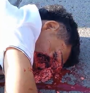 [ FULL VIDEO] Cracked skull of motorcyclist killed in brutal accident