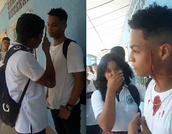 Dude Gets Face Slashed By Cruel Classmate