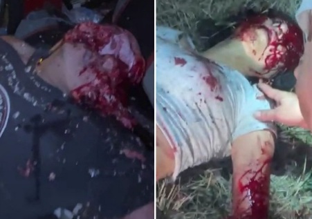 Horrific car and bus collision leave many gored dead victims 