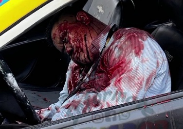 Taxi driver shoot dead in his car