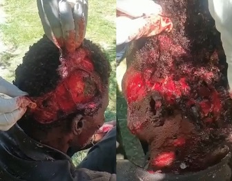 Don't Bring Your Head to a Machete Fight