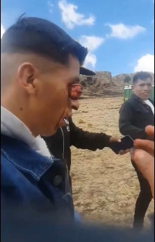 Moron Loses Eye At Bull Show In Peru