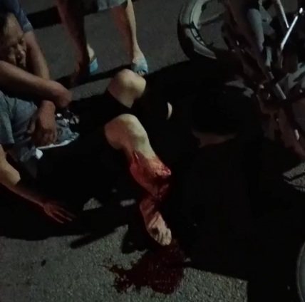 Motorcyclist horrifically broken his leg 