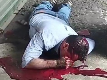 man victime of sicario headshot still alive with bullet hole in his head 