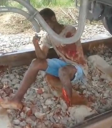 FUCK, Angolan has arm and leg severed by train