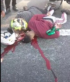 Motorcycle accident victim broke his skull
