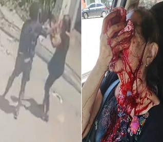 Psycho Stabs Random Woman In the Face (Action & Aftermath)