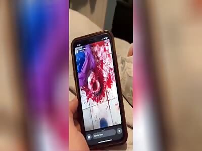 Teen Livestreams Aftermath After Bludgeoning Family Member To Death