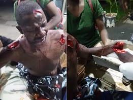 Dude Seriously Wounded After Being Attacked With A Machete