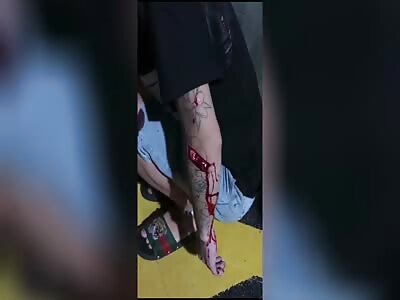 victim is already attacked with a machete