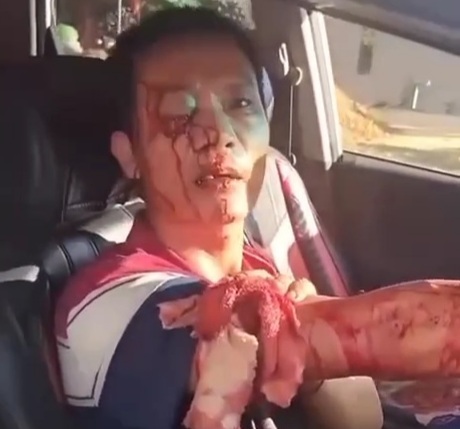 Chinese taxi driver victim of armed robbery 