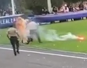 During Graduation Show Student Accidentally Burn Himself with Flares 