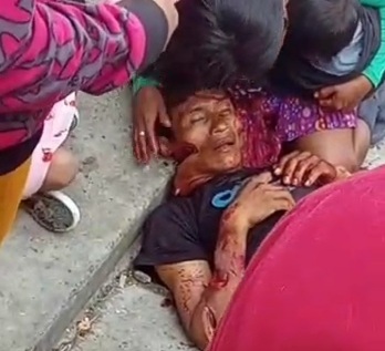 Father sliced by machete in front of his wife and kid 