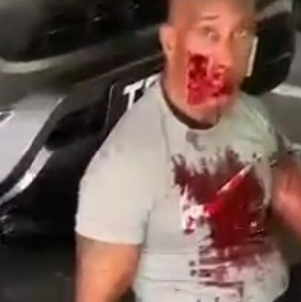 Attempt To Kill Gym Owner - Shot in Mouth ACTION & AFTERMATH