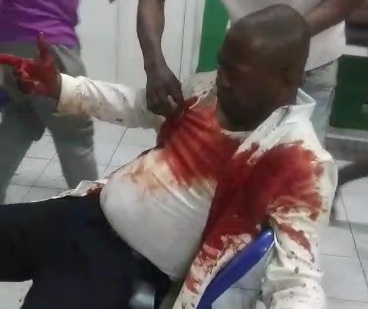 Wounded civilian in hospital after getting shoot by gang member