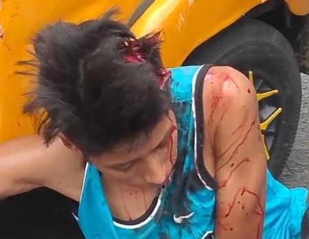 Tricycle driver lost control and crushed hard 