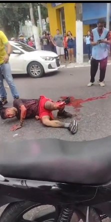 Brazilian man had his leg seriously injured