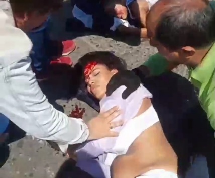 Wounded mother and his child lying on the street after bike crashed 