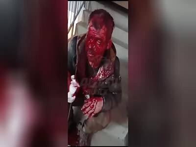 She Turned Husband's Face into Bloody Mess due to Suspicions of Treason