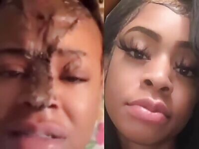  Woman Has Acid Thrown On Her Face By Her Own Sister