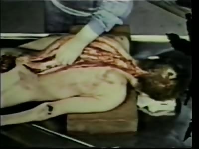 Traces of Death Classic Autopsy