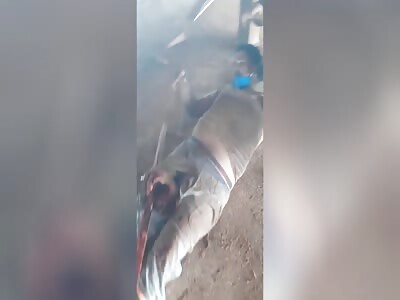 man has his leg brutally injured in a work accident