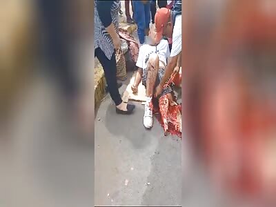 Old Man with smashed leg by a bus driver