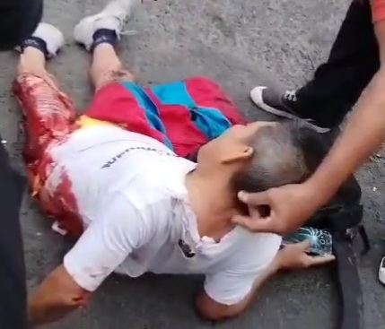 Horrific legs injury after old man crashed by bus 