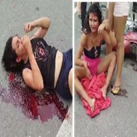 Women Suffer Accident
