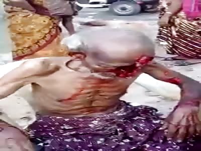 90 Year Old Man in Agony After his Face Been Ripped Off by Stray Dogs