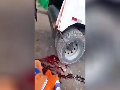 Horrible Work Day.. Garbage Collector's Head Is Crushed