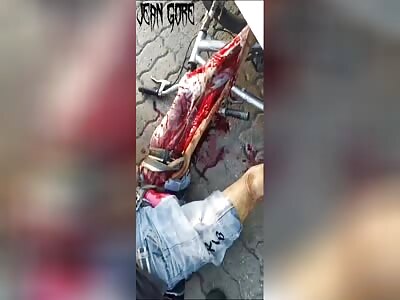 cyclist has his leg grazed