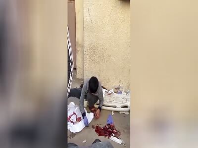 The war in Israel turns civilians into pieces