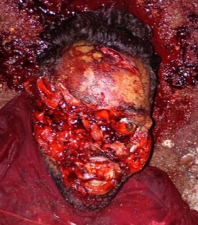 DAMN: Somehow This Man Is Still Alive...