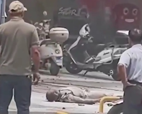 Worker Burns Himself after being Fired