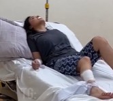 Asian girl is dying of rabies
